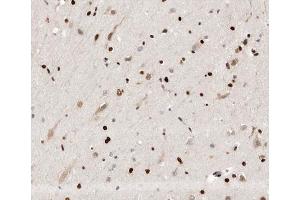 ABIN6266649 at 1/100 staining human brain tissue sections by IHC-P. (UBR5 Antikörper  (N-Term))