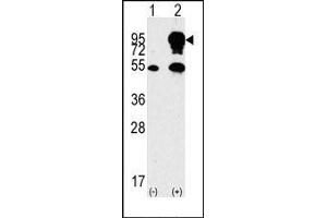 Image no. 1 for anti-B-Raf proto-oncogene, serine/threonine kinase (BRAF) (Middle Region) antibody (ABIN360129) (BRAF Antikörper  (Middle Region))