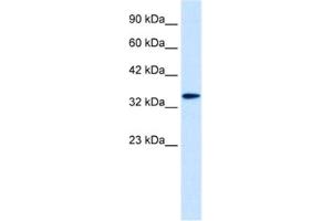 Western Blotting (WB) image for anti-Distal-Less Homeobox 6 (DLX6) antibody (ABIN2461204) (DLX6 Antikörper)