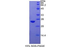SDS-PAGE analysis of Cow PPARG Protein. (PPARG Protein)
