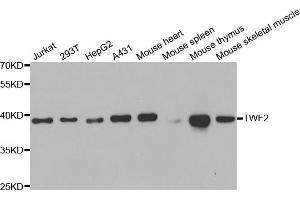 Western blot analysis of extracts of various cell lines, using TWF2 antibody (ABIN5973471) at 1/1000 dilution. (TWF2 Antikörper)