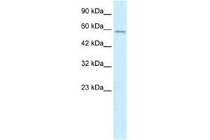 Human HepG2; WB Suggested Anti-MGC4618 Antibody Titration: 0. (TMEM175 Antikörper  (N-Term))