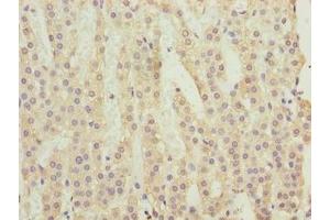 Immunohistochemistry of paraffin-embedded human adrenal gland tissue using ABIN7174836 at dilution of 1:100 (C3orf18 Antikörper  (AA 83-162))