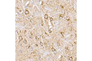 Immunohistochemistry of paraffin-embedded rat brain using NDUFB9 Rabbit mAb (ABIN7268815) at dilution of 1:200 (40x lens). (NDUFB9 Antikörper)