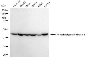 Western blotting analysis using Phosphoglycerate kinase 1 antibody (ABIN7799809). (PGK1 Antikörper)