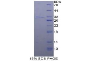 SDS-PAGE analysis of Human Cadherin 16 Protein. (Cadherin-16 Protein (CDH16))