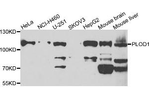 Western blot analysis of extracts of various cell lines, using PLOD1 antibody.