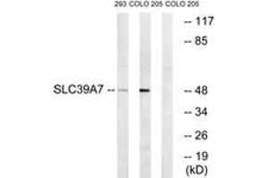 Western Blotting (WB) image for anti-Solute Carrier Family 39 (Zinc Transporter), Member 7 (SLC39A7) (AA 131-180) antibody (ABIN2890706) (SLC39A7 Antikörper  (AA 131-180))