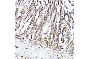 Immunohistochemistry (IHC) image for anti-G protein beta subunit-like (GBL) (AA 1-326) antibody (ABIN6143894)