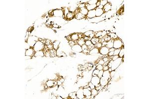 Immunohistochemistry (IHC) image for anti-Uncoupling Protein 1 (Mitochondrial, Proton Carrier) (UCP1) (AA 1-307) antibody (ABIN6149883)