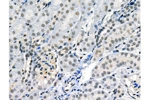 Phospho-JAK2 (Tyr1007/Tyr1008) Antibody at 1/100 staining Mouse kidney tissue by IHC-P.