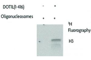 DOT1L (1-416), active activity assay using Recombinant Nucleosomes as substrates.