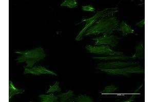 Immunofluorescence of monoclonal antibody to DPH2 on HeLa cell. (DPH2 Antikörper  (AA 1-489))