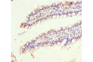 Immunohistochemistry of paraffin-embedded human small intestine tissue using ABIN7169557 at dilution of 1:100 (SIGLEC12 Antikörper  (AA 20-210))