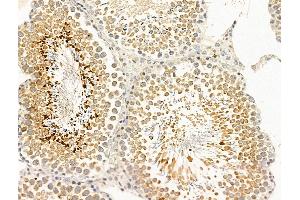 ABIN7094857 and ABIN7098908 at 1/100 staining Rat testis tissue by IHC-P. (CCDC34 Antikörper  (C-Term))