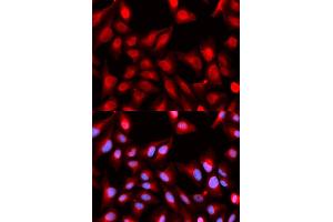 Immunofluorescence analysis of U2OS cells using DDX5 antibody (ABIN5973042). (DDX5 Antikörper)