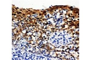 IHC-P: 14-3-3 sigma antibody testing of human tonsil tissue (14-3-3 sigma/SFN Antikörper  (AA 140-156))