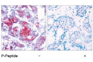 Image no. 1 for anti-Signal Transducer and Activator of Transcription 4 (STAT4) (pTyr693) antibody (ABIN196694) (STAT4 Antikörper  (pTyr693))