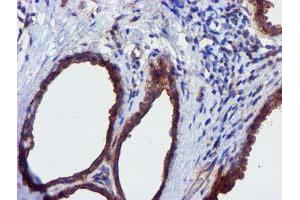 Immunohistochemical staining of paraffin-embedded Human breast tissue using anti-EPN2 mouse monoclonal antibody. (Epsin 2 Antikörper)