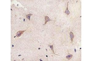 IHC analysis of FFPE human brain section using TSC2 antibody; Ab was diluted at 1:25. (Tuberin Antikörper  (AA 1397-1426))