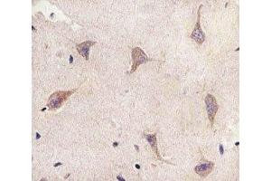 Immunohistochemistry (IHC) image for anti-Tuberous Sclerosis 2 (TSC2) (AA 1397-1426) antibody (ABIN3029313)
