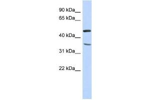 FAM81B antibody used at 1 ug/ml to detect target protein. (FAM81B Antikörper  (N-Term))