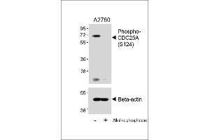 Western blot analysis of lysates from  cell line, untreated or treated with Alkaline phosphatase, 1h, using 459088101 A (upper) or Beta-actin (lower). (CDC25A Antikörper  (pSer124))