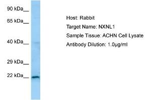 Western Blotting (WB) image for anti-Nucleoredoxin Like Protein 1 (NXNL1) (N-Term) antibody (ABIN2790127) (NXNL1 Antikörper  (N-Term))