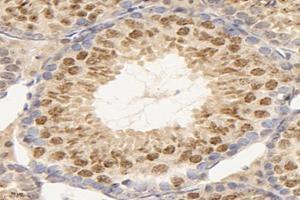 Immunohistochemistry analysis of paraffin-embedded mouse testis using,TEX11 (ABIN7075862) at dilution of 1: 2000 (TEX11 Antikörper)