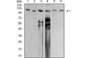 Western blot analysis using SMARCA1 mouse mAb against PANC-1 (1), HEK293 (2), SW620 (3), HT-29 (4), SH-SY5Y (5), and SK-OV-3 (6) cell lysate. (SMARCA1 Antikörper  (AA 933-1070))