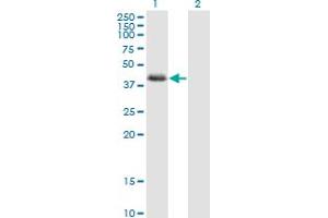 Western Blot analysis of NDRG2 expression in transfected 293T cell line by NDRG2 monoclonal antibody (M03), clone 6A5. (NDRG2 Antikörper  (AA 1-96))