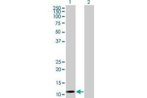 Western Blotting (WB) image for NDUFA13 293T Cell Transient Overexpression Lysate(Denatured) (ABIN1336270)