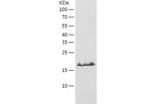 PDCD6 Protein (AA 1-191) (His tag)