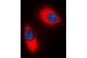 Immunofluorescent analysis of p47 phox staining in Jurkat cells. (NCF1 Antikörper  (C-Term))