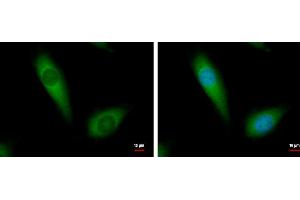 ICC/IF Image NDUFA10 antibody [N1C3] detects NDUFA10 protein at cytoplasm by immunofluorescent analysis.