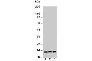 Western blot testing of MIF antibody and Lane 1:  HeLa (MIF Antikörper  (C-Term))