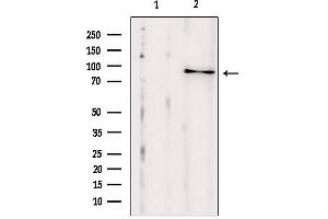 Western blot analysis of extracts from HepG2, using SEC5/EXOC2 antibody. (EXOC2 Antikörper  (N-Term))