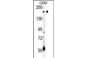 Western blot analysis in CEM cell line lysates (35ug/lane). (TRPM6 Antikörper  (AA 317-348))