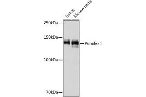 Western blot analysis of extracts of various cell lines, using Pumilio 1 Rabbit mAb (ABIN1682469, ABIN3015222, ABIN3015223 and ABIN7101323) at 1:1000 dilution.