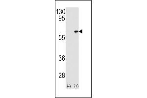 Western blot analysis of P3K7IP1 (arrow) using rabbit polyclonal P3K7IP1-p (ABIN390845 and ABIN2841072). (TAB1 Antikörper  (AA 401-430))