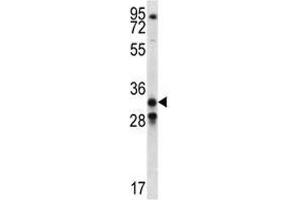 GDF15 antibody western blot analysis in NCI-H460 lysate (GDF15 Antikörper  (AA 51-79))