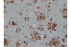 Immunostaining of paraffin embedded brain section from transgenic mouse expressing human APP (dilution 1 : 2000).