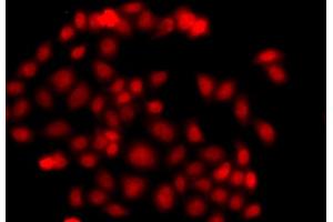 Immunofluorescence analysis of  cells using MLF1 antibody (ABIN6128237, ABIN6143874, ABIN6143876 and ABIN6217281). (MLF1 Antikörper  (AA 1-268))