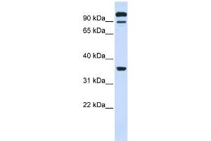PTPRE antibody used at 1 ug/ml to detect target protein. (PTPRE Antikörper  (Middle Region))