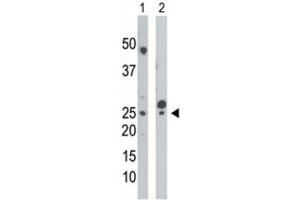 Western Blotting (WB) image for anti-Uridine-Cytidine Kinase (UCK) antibody (ABIN3003699) (UCK Antikörper)
