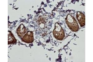Expression of CB2 receptor in rat dermis - Immunohistochemical staining of paraffin embedded section of rat dermis using Anti-Cannabinoid Receptor 2 Antibody (ABIN7043025, ABIN7044157 and ABIN7044158), (1:100). (CNR2 Antikörper  (AA 228-242))