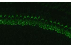 Immunostaining of cochlear inner hair cells (IHCs) from p17 C57black mouse.