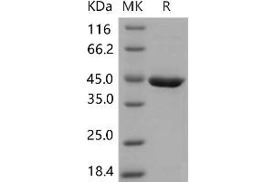 SERPINB10 Protein (His tag)