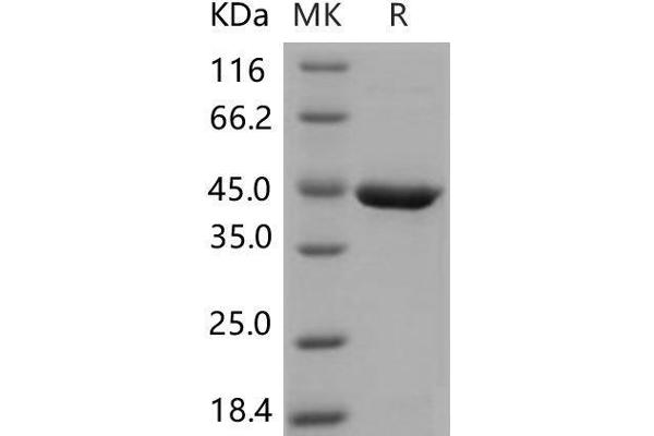 SERPINB10 Protein (His tag)