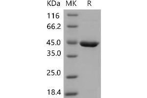 Western Blotting (WB) image for serpin Peptidase Inhibitor, Clade B (Ovalbumin), Member 10 (SERPINB10) protein (His tag) (ABIN7320212) (SERPINB10 Protein (His tag))